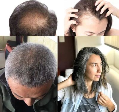 洗頭水中撒一把，頭發長得又快又茂密，白發都沒了！